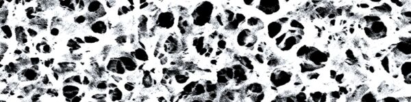 SEM of surface of PVDF membrane
